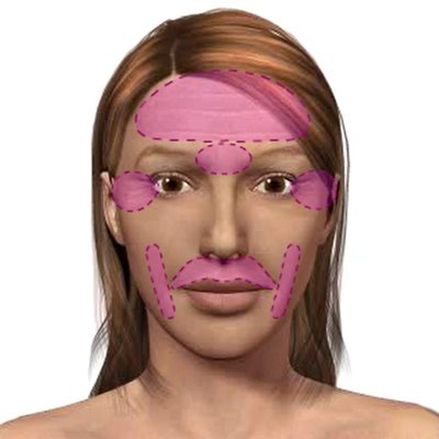 Nonsurgical Cosmetic Procedures Picture