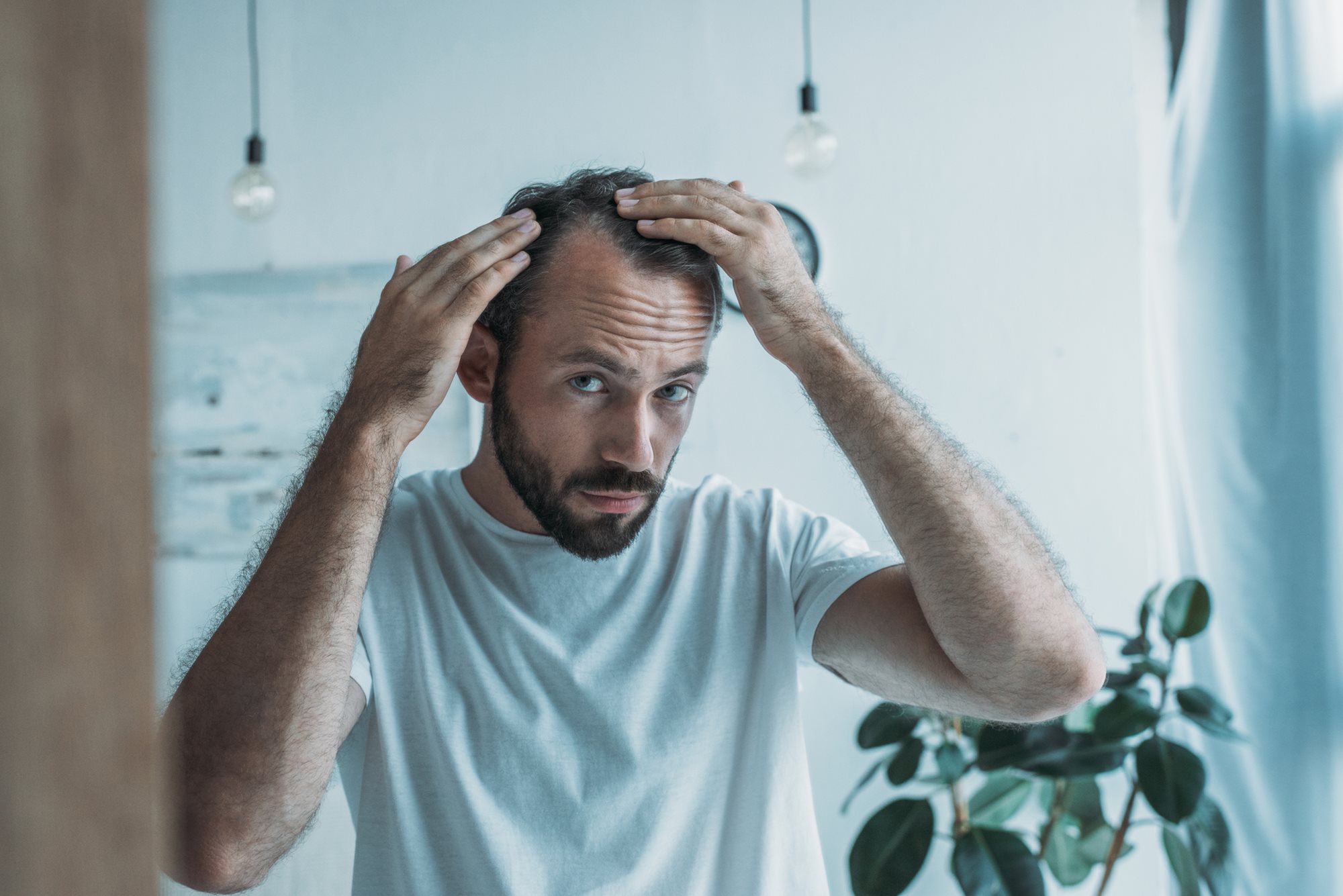 Men’s Health Month: Can you prevent hair loss?